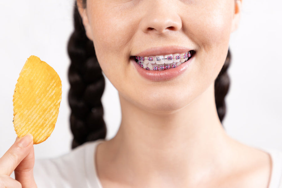 Kann man Chips mit Zahnspangen essen? Tipps & sichere Optionen